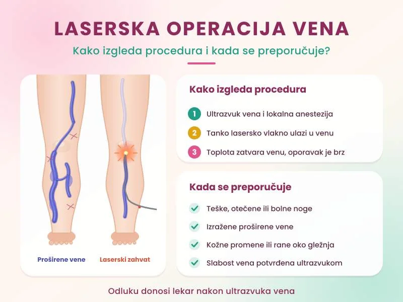 Laserska operacija vena: kako izgleda procedura i kada se preporučuje?